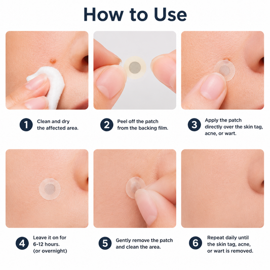 🔥 CVS®2-in-1 Microneedle & Hydrocolloid Patch🔥| Removes Raised Moles, Acne, Flat Warts & Skin Tags | Helps Improve Wrinkles, Scars & Blemishes | Invisible Patches for Face & Body