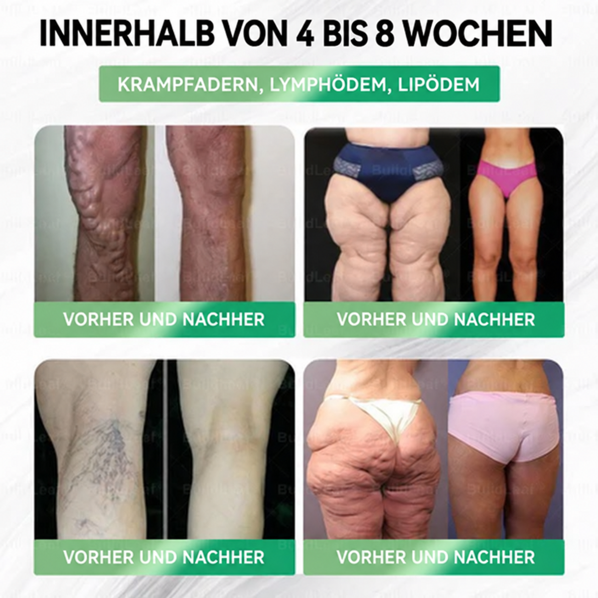 ⏰ GLP-1 8-in-1 Slim & Healthy Lösung | 1× täglich – sichtbare Ergebnisse in 7 Tagen | Für Gewicht, Herz, Blutzucker, Schlaf, Darm, Gelenke, Haut & Energie | CE · MDR (EU) 2017/745 · BfArM