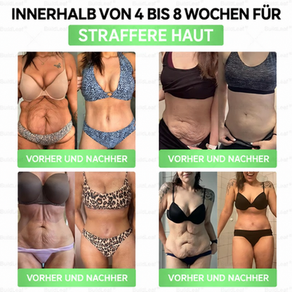 ⏰ GLP-1 8-in-1 Slim & Healthy Lösung | 1× täglich – sichtbare Ergebnisse in 7 Tagen | Für Gewicht, Herz, Blutzucker, Schlaf, Darm, Gelenke, Haut & Energie | CE · MDR (EU) 2017/745 · BfArM