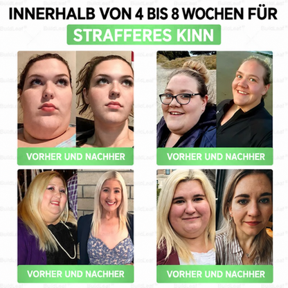 ⏰ GLP-1 8-in-1 Slim & Healthy Lösung | 1× täglich – sichtbare Ergebnisse in 7 Tagen | Für Gewicht, Herz, Blutzucker, Schlaf, Darm, Gelenke, Haut & Energie | CE · MDR (EU) 2017/745 · BfArM