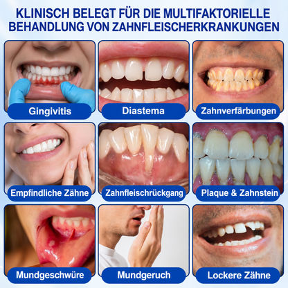 🏅🦷📌 Vivanoura® Zahnfleisch-Regenerationsgel für Parodontitis
