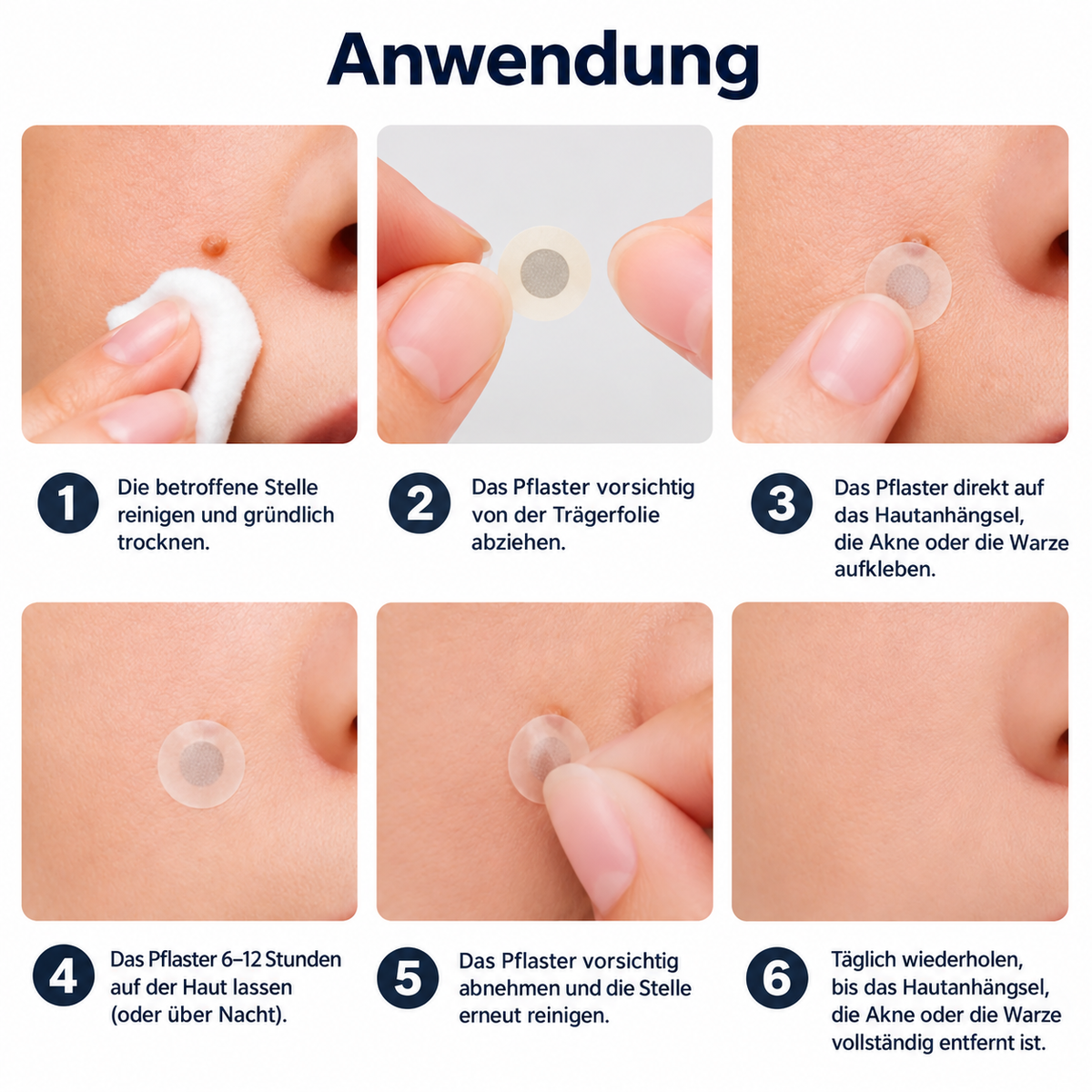 🔥 2-in-1 Mikronadel- & Hydrokolloid-Pflaster 🔥 | Entfernt erhabene Muttermale, Akne, flache Warzen & Hautanhängsel | Hilft, Falten, Narben & Hautunreinheiten zu verbessern | Unsichtbare Pflaster für Gesicht & Körper
