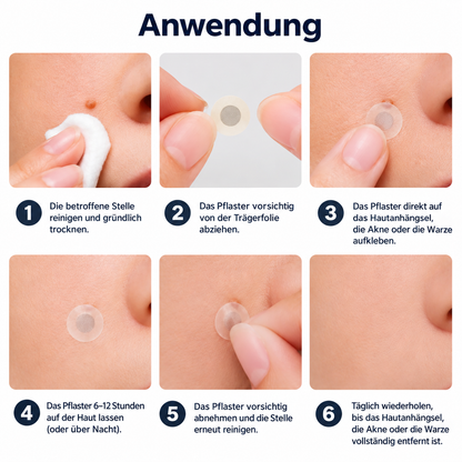 🔥 2-in-1 Mikronadel- & Hydrokolloid-Pflaster 🔥 | Entfernt erhabene Muttermale, Akne, flache Warzen & Hautanhängsel | Hilft, Falten, Narben & Hautunreinheiten zu verbessern | Unsichtbare Pflaster für Gesicht & Körper